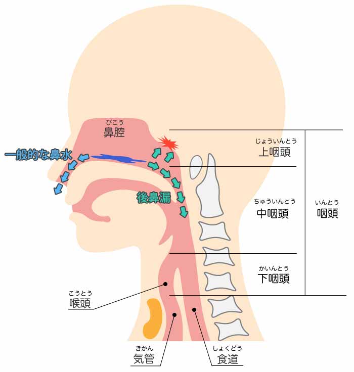 後鼻漏は治る病気なの？